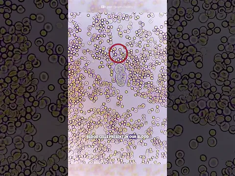 White blood cell fight with germs #science #sciencefacts