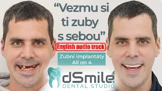 Nové Zuby na pevno za jednou návštěvu! Jak probíhá zubní Implantace