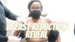 My Breast Reduction Reveal, Day 2/3 of Bed Rest, Finally Seeing My New Breast
