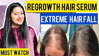 21 Days Hair Challenge Ayurvedic Nuskha for Hair Fall and REGROW New Hair