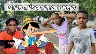 ¡IMPRESIONATE! Este HOMBRE tiene la NARIZ más GRANDE que PINOCHO.