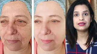 ANTI AGEING CHALLENGE : Remove Wrinkles, Fine Lines, Open Pores & Get Tight Bright Skin Naturally