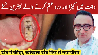 Top 4 Home Remedies For Tooth Cavity | Dental Carries - Dr Javaid