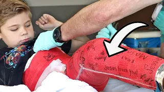 Ollie Gets His Cast Removed!