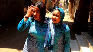 توأم ملتصق عملو عمليه شوفو مين مات فيهم؟؟
