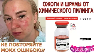 ХИМИЧЕСКИЙ ПИЛИНГ ДОМА | МОЙ ПЕЧАЛЬНЫЙ ОПЫТ