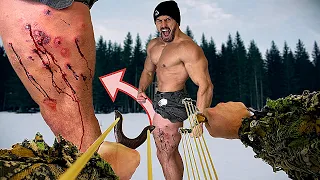 Creating the WORST SLINGSHOT INJURY of all Time | Bodybuilder VS Ultimate Slingshot Experiment