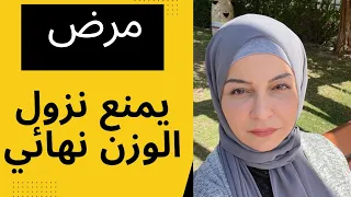 انتبهي !! الليبيديما |الوذمة الشحمية تمنع نزول الوزن .