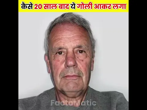 कैसे 20 साल बाद ये गोली लगा 😱 देखकर चौंक जाओगे #Shorts
