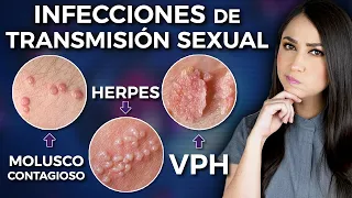 Infecciones de Transmisión Sexual⚠️ l Lo que tienes que saber 👩🏻‍⚕️