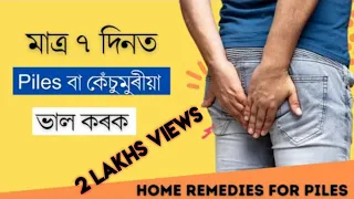 Piles বা কেঁচুমুৰীয়া ৰ ক্ষেত্ৰত সকলোতকৈ উপযোগী ঘৰুৱা চিকিৎসা  || Treatment for Piles