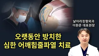 오랫동안 방치한 어깨 회전근개파열 치료사례