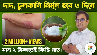 মাত্র ২ টাকা খরচ করলেই দাদ, হাজা, চুলকানি থেকে চিরতরে মুক্তি পাওয়া যায়।| Easy Ringworm Treatment.|
