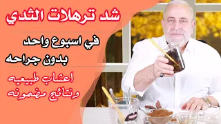 شد الثدي المترهل بدون وبطريقة طبيعيه خلال اسبوع