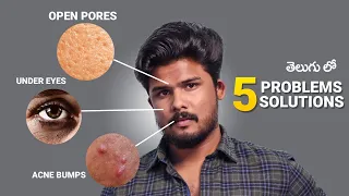 5 SKIN PROBLEMS, 5 EASY SOLUTIONS | Not Sponsored | Men's Grooming In Telugu | The Fashion Verge