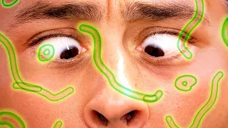 Por que você enxerga SUJEIRINHAS flutuando nos olhos?