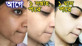 গোসলের আগে লাগাও দাগহীন ফর্সা ত্বক পার্লারের দরকার পরবে না/Skin Whitening Facial/FairGlow