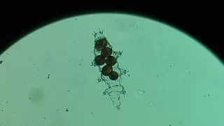 Nacimiento de Tardígrados En Vivo Bajo el microscopio 🔬