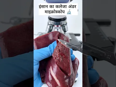 Human Liver Under Microscope 🔬 #shorts #shortvideo #youtubeshorts #microscope