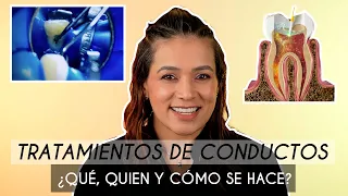 Tratamiento de Conductos 🦷 (Endodoncia) ¿Qué se hace? 😖 ¿Duele? - Odontología Láser.