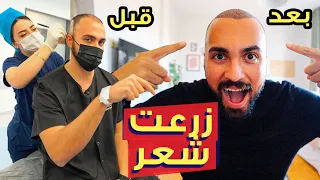 تجربتي مع زراعة الشعر وعمليات التجميل في تركيا | هل مستهلة؟