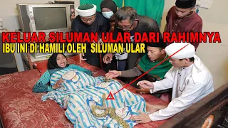 IBU INI DIHAMILI SILUMAN ULAR KELUAR ULAR DARI RAHIMNYA !!