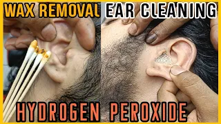 Dirtiest Ear Cleaning and Wax Removal by REIKI MASTER💈MASTER ASMR💈#asmr