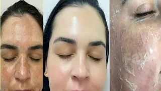 أقوي وصفه لتبييض تخلي وجهك وجسمك كيف المرايا بياض كاثلج 😌🌸