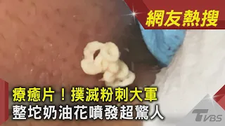 療癒片！撲滅粉刺大軍　整坨奶油花噴發超驚人｜TVBS新聞｜網友熱搜