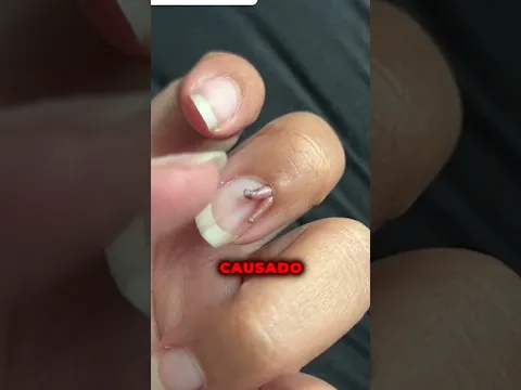 No tires de él 😨