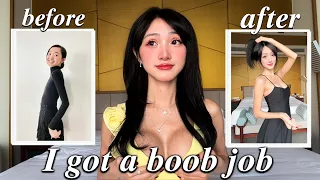 I HAD A BOOB JOB. (my surgery experience, size, recovery, complications,...)