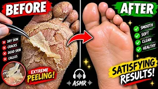 FOOT PALM TREATMENT LIVE 🔴🦶🏻