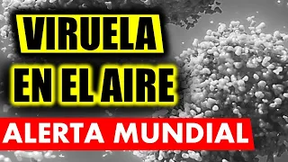 ¡URGENTE! 💥VIRUELA DEL MONO PUEDE CONTAGIAR POR AIRE💥
