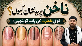 Nakhun ke SECRET MARKS || Dr. Fahad Artani Roshniwala | Roshni Centre