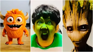 CRAZIEST bicsmalln Funny YouTube shortsCompilation Try Not To Laugh Watchingbicsmalln Challenge 2025
