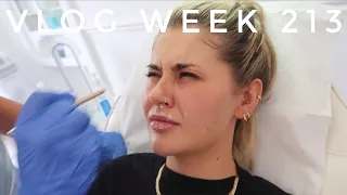 BOTOX BROW LIFT & A MINI HOUSE TOUR - VLOG WEEK 213 | JAMIE GENEVIEVE