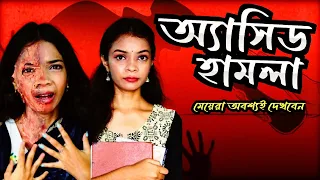 অ্যাসিড হামলা ll Acid Attack ll মেয়েরা অবশ্যই দেখবেন ll ALSI YT ll