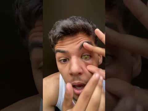 توكيب عدسة العين 😂😂😳 #shortvideo #shortsviral #funny #shorts #short