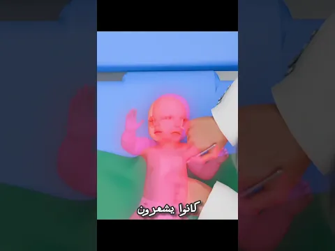​😱 عمليات جراحية بدون تخدير؟ الكابوس الحقيقي للأطفال!