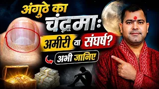 Anguthe Par Chand Ka Nishan | Anguthe Mein Chand Ka Nishan | Anguthe Mein Chandrama Ka Nishan #Thumb