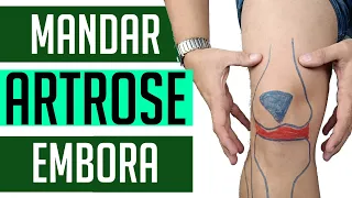 ARTROSE NO JOELHO - 4 EXERCÍCIOS PARA MELHORAR AGORA!