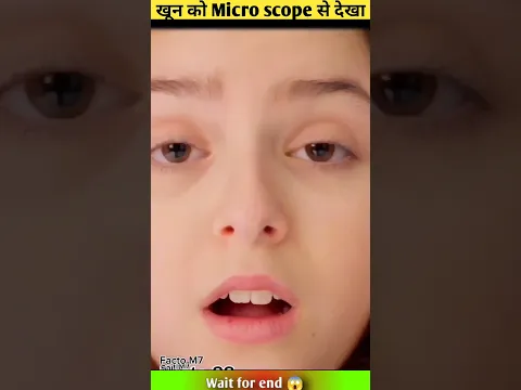 खून को Micro scope से देखा 😱 ~mini wood toy / @MicroMasterr  @theSachinfacts852  #shorts