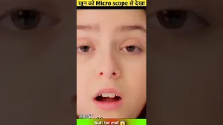 खून को Micro scope से देखा 😱 ~mini wood toy / @MicroMasterr  @theSachinfacts852  #shorts