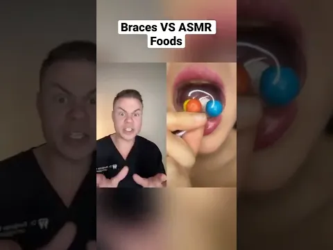 ASMR Foods VS Braces!