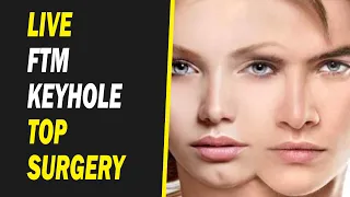 Live FTM Keyhole Top Surgery Planning And Marking
