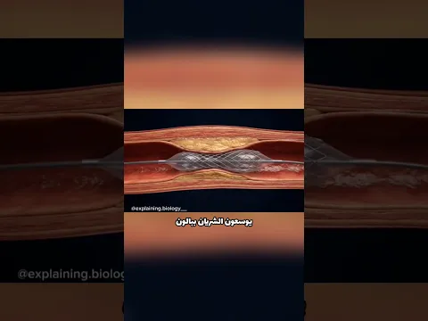 ابتكار أنقذ الملايين