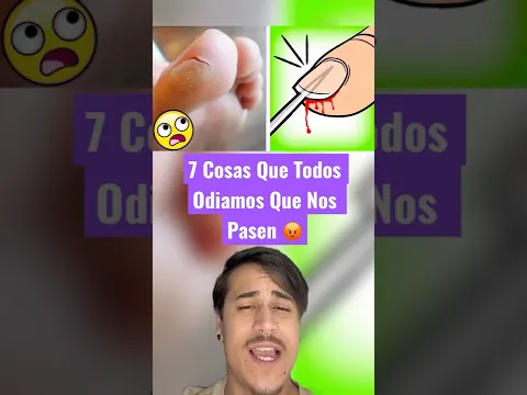 7 Cosas Que Todos Odiamos Que Nos Pasen 😡 #shorts