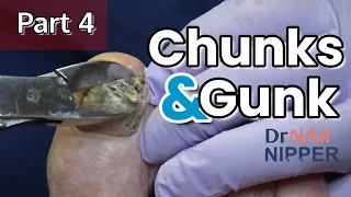 #4 Chunks and Gunk (2021)