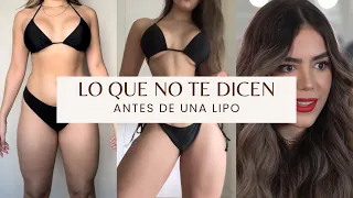 Lo que no te dicen antes de una Lipo 😨