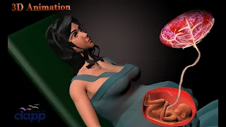 Fertilization, Development of Placenta ,Labor and Delivery,   (3D Animation)